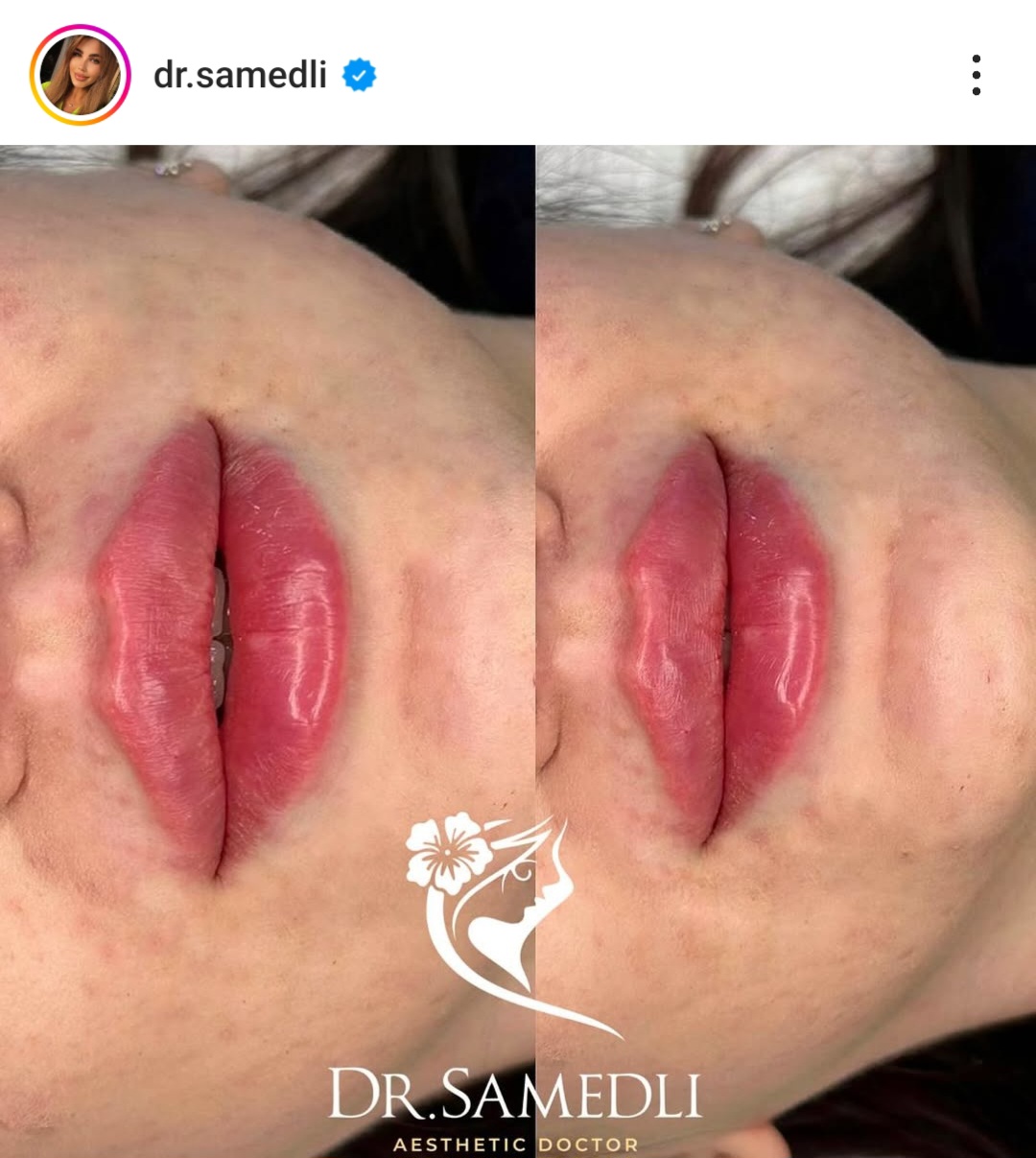 image-screenshot_20250520_105814_instagram